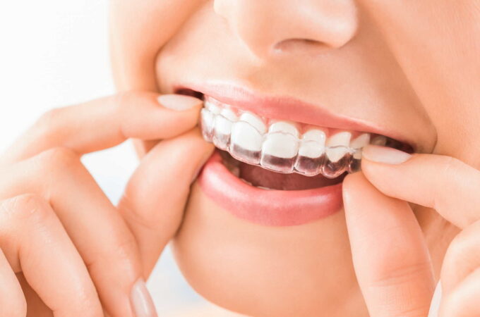 Beautiful smile and white teeth of a young woman.